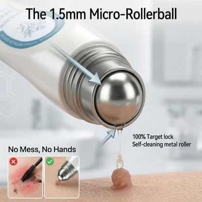 𝐑𝐚𝐥𝐚𝐝𝐲® 𝟕-𝐷𝑎𝑦 𝗧𝐚𝐠 & 𝗦𝗽𝐨𝐭 𝐄𝐫𝒂𝒔𝒆𝒓(𝐙𝐞𝐫𝐨 𝐏𝐚𝐢𝐧, 𝐙𝐞𝐫𝐨 𝐒𝐜𝐚𝒓𝒔 𝐑𝐨𝐥𝐥𝐞𝐫𝐛𝐚𝐥𝐥)💪